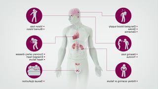 Image of how hypertension affects the human body